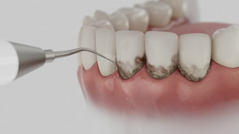 Reliable Dental Implants contractor in Terrell County County, TX by Dentist Open Now